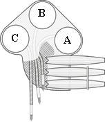 3-Channel Implant Receiver